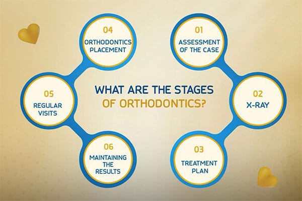 https://www.miskdent.com/wp-content/uploads/2024/02/What-are-the-stages-of-orthodontics.jpg